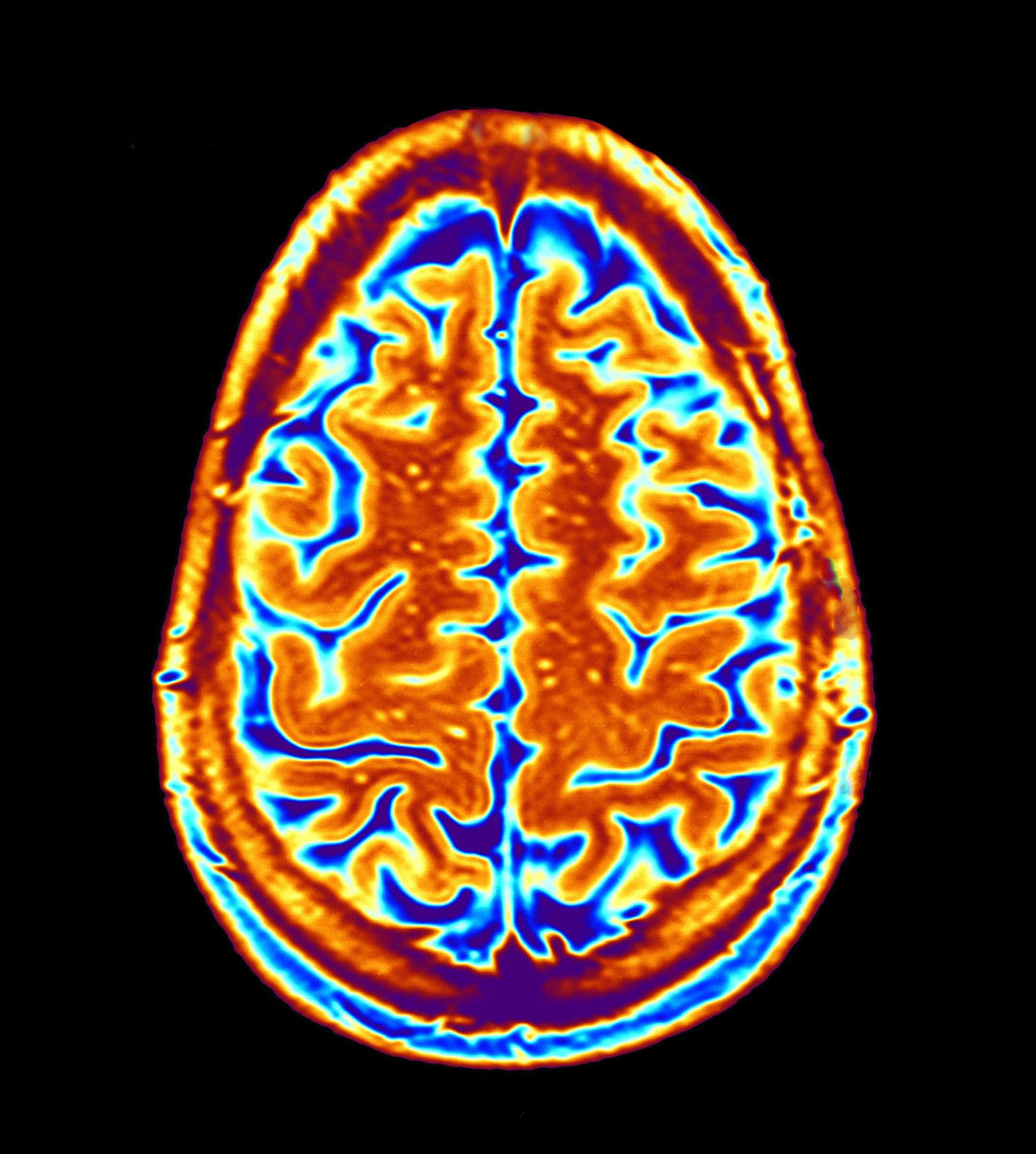 Growing your Brain with Lion's mane
